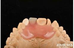 China High Stealth Good Elasticity Flexible Denture Finish For Diverse Manufacturing Processes supplier
