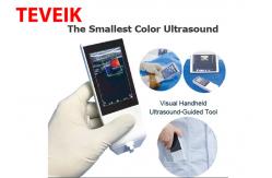 China Medical Wifi Ultrasound Machine Android Portable Wireless Ultrasound Probe Linear supplier