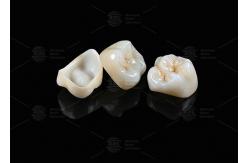 China Natural Full Contour Zirconia Crown Precise Fit Full Contour Dental Lab supplier