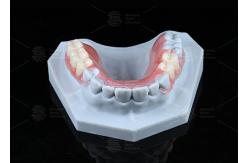 China TCS Flexible Partial Stain Resistant BPA Free Partial Dentures For Natural Look supplier