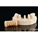 Unveil True Biomimicry: Introducing Our Multi-Layered Zirconia Aesthetic Bridge for sale