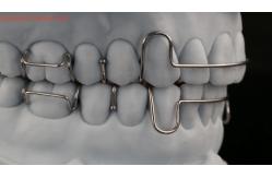 China Teeth Expansion And Distalization Orthodontist Palate Expander China Dental Lab supplier