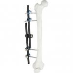 Hot Sale Orthopedic Surgical Instruments Tibial & Femur External Fixator AO External Fixation Orthopedic Instrument for sale