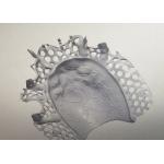 CAD Design Titanium Alloy Partial Denture Metal Framework