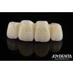 Biologically Oriented Preparation Technique BOPT For Accurate Dental Preparation