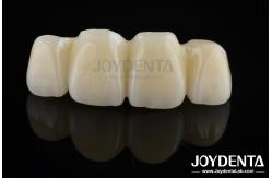 China Biologically Oriented Preparation Technique BOPT For Accurate Dental Preparation supplier