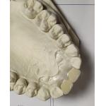 Comfortable Fit ISO13485 RPD Soft Invisible Denture