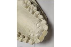China Comfortable Fit ISO13485 RPD Soft Invisible Denture supplier