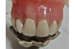 China Esthetics Full Denture Cold Cured Acrylic Partial Denture supplier