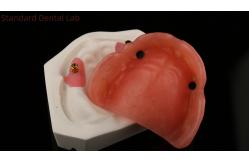 China Dentsply Lucitone 199 Acrylic Denture For Full Arch Natural Look supplier