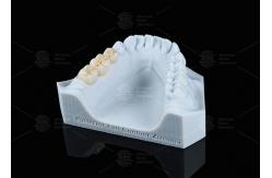 China Translucency White Full Contour Zirconia Crown FCZ Monolithic Zirconia Crown Easy Milling supplier