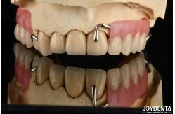 China Elaborate Framework Final Set Stable Dental Structure Designed Teeth Finish supplier