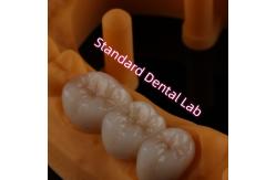 China High Translucent PFZ Layered Zirconia Bridge Porcelain Ceramic Posterior supplier