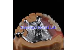 China Upper Cast Framework Acrylic Metal Partial Dentures Strong Lightweight and Durable supplier