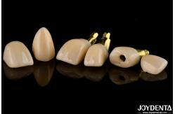 China Precision Dental Implant Crown and Bridge Perfect Solution for Aesthetically Pleasing Smile supplier