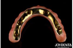 China Natural Teeth And Gums Compatible Ti-Bar Zirconia Hybrid Bridge With High Biocompatibility supplier