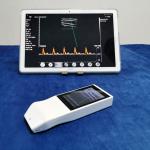 Wireless Ultrasound Tranducer Android Color Doppler Ultrasound Probe Wireless Charging for sale