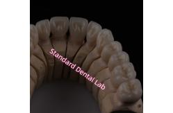 China Digital CAD CAM Dental Lab PFZ Crowns Translucent Layered Zirconia Crown supplier