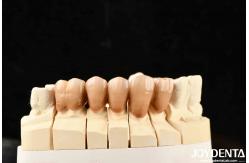 China Bionic Development Leaves And Distinct Layers Of Zirconia All-Ceramic supplier