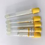 Professional Serum Clot Activator Tubes Separation Yellow Cap vacuum blood colletion tube for sale