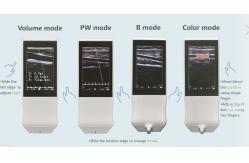 China Medical Wifi Ultrasound Machine Android Portable Wireless Ultrasound Probe Linear supplier