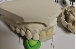 China Temporary Soft And Elastic Valplast Invisible Denture supplier