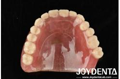 China Good Biocompatibility Personalized Customization Acrylic Denture Finish For Lightweight And Durable Solutions supplier