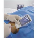 Medical Wifi Ultrasound Machine Android Portable Wireless Ultrasound Probe Linear