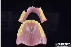 China Advanced Tooth Arrangement Technology Acrylic Denture Finish With Good Elasticity And Diverse Features supplier