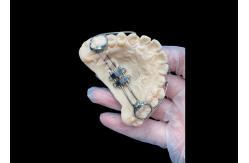 China MSE Palatal Expander Innovative Orthodontic Appliances For Effective Teeth Alignment supplier