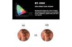 China DEC 3840A New 4K Ultra HD Medical Endoscope Camera System For Laparoscopy supplier
