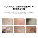 ODM 15ml Permanent Makeup Pigments Remove Stretch Marks