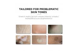 China ODM 15ml Permanent Makeup Pigments Remove Stretch Marks supplier