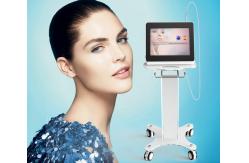 China Distridutor wanted!!! Super effect beauty machine personal care vascular therapy spider ve supplier