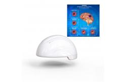 China Transcranial Magnetic Stimulation Neurofeedback Devices 810nm Infrared Stroke supplier