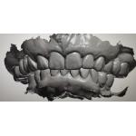 CAD CAM Design Digital Display Mockup Teeth Other Dental Products for sale