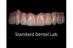 China Titanium Full Zirconia Bridge Dental Translucency On Implant Bar supplier