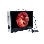 Portable Full HD Endoscope Camera For ENT Laparoscopy Hysteroscopy Cystoscopy Surgery Equipment for sale