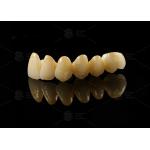 China Strong Aesthetic Porcelain Fused To Zirconia For Natural Looking Restorations for sale