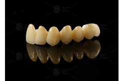 China Strong Aesthetic Porcelain Fused To Zirconia For Natural Looking Restorations supplier