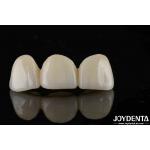 Natural-looking Style With Layers Full Zirconia High Translucency And Aesthetics