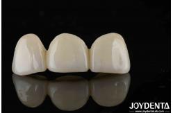 China Natural-looking Style With Layers Full Zirconia High Translucency And Aesthetics supplier