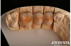 China High Chipping Resistance And Natural-looking Esthetics With Multilayer Full Zirconia Technology supplier