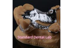 China Laser Printing Cobalt Chrome Partial Denture With Clear Clasps supplier