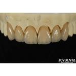 Excellent Biocompatibility Layered Zirconia Within High Aesthetics And Density 6.0-6.1 G/cm3 for sale