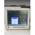 12.1 inch Patient monitor 6 parameters mobile ambulance patient monitor