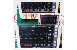 China PHiliph Efficia CM10 Used Patient Monitor Medical Equipment 90 Days Warranty supplier