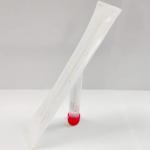 150mm Viral Transport Medium Plastic 2 Years Shelf Life for sale
