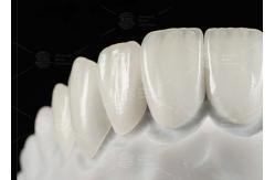 China Natural Pressed EMAX Veneer Strength 16 Shades Emax Teeth Veneers supplier