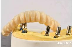 China Unmatched Accuracy Zirconia Implant Bridge Commitment To Comfort supplier